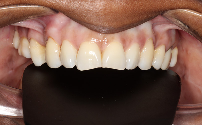Before - Aventis dental