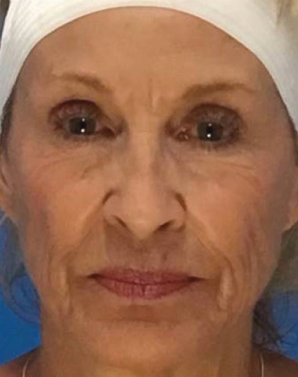 After - Aventis dental