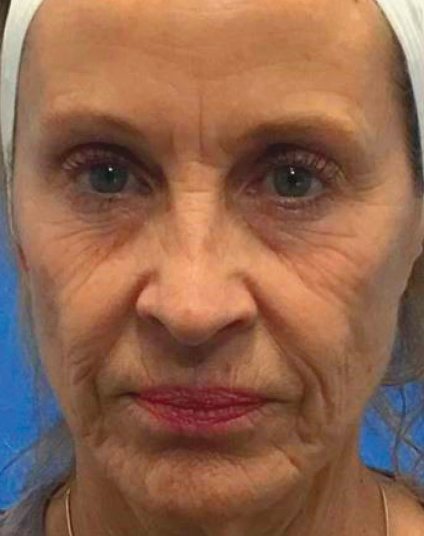 Before - Aventis dental