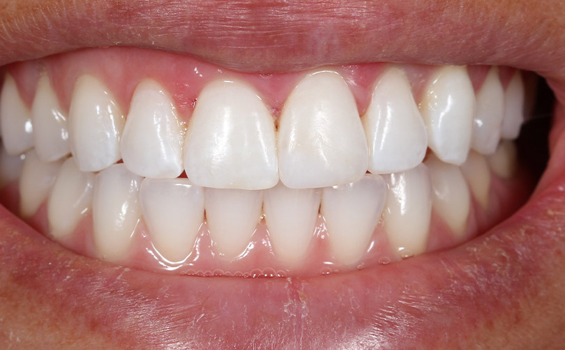 After - Aventis dental