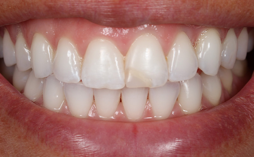 Before - Aventis dental
