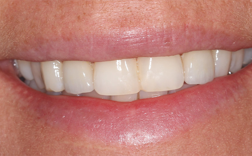 After - Aventis dental