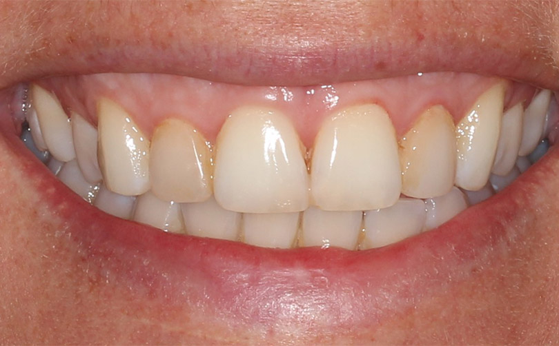 Before - Aventis dental
