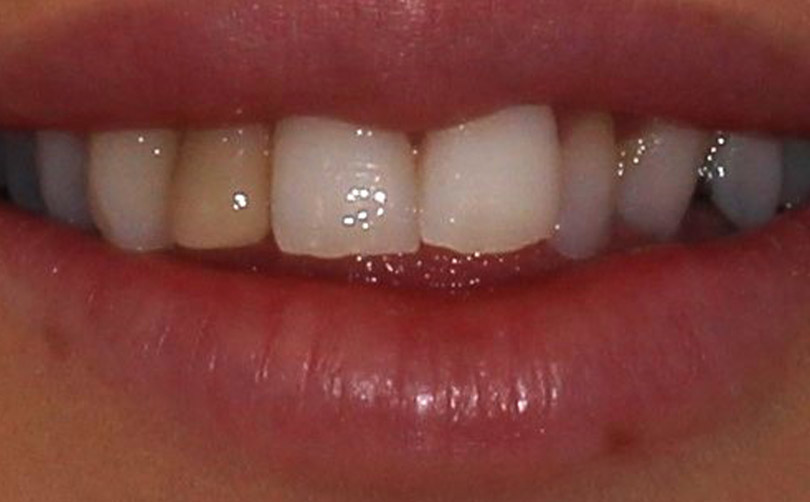 Before - Aventis dental