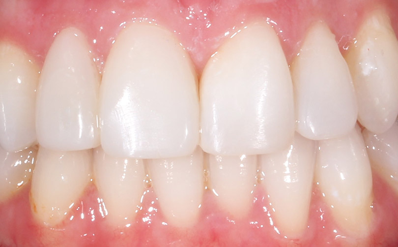After - Aventis dental