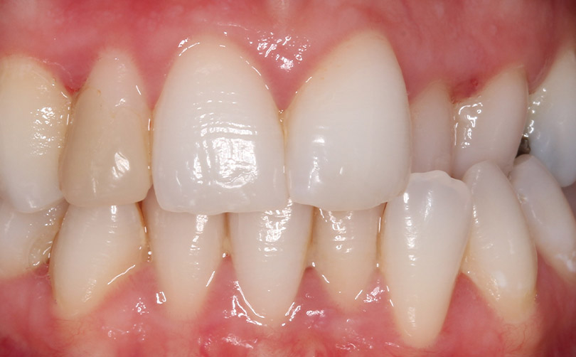 Before - Aventis dental